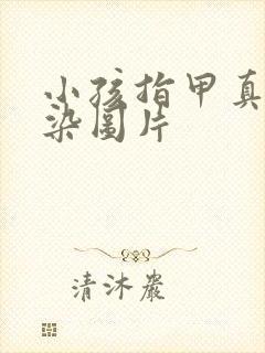 小孩指甲真菌感染图片