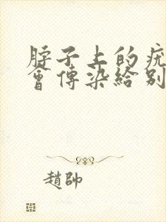 脖子上的疣会不会传染给别人封面