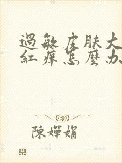 过敏皮肤大面积红痒怎么办吃什么药封面