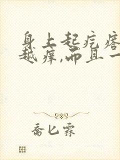 身上起疙瘩越挠越痒,而且一片一片红封面