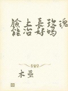 脸上长玫瑰痤疮能冶好吗