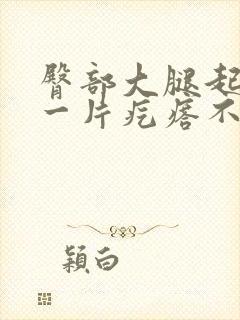 臀部大腿起红色一片疙瘩不痛不痒