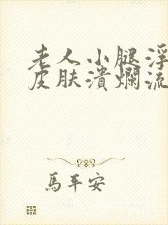 老人小腿浮肿且皮肤溃烂流水