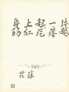 身上起一片一片的红疙瘩越挠越痒