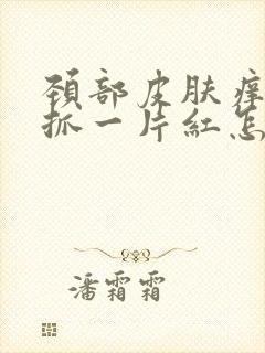 颈部皮肤痒时一抓一片红怎么回事封面