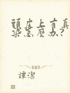 头皮上有真菌感染怎么办?