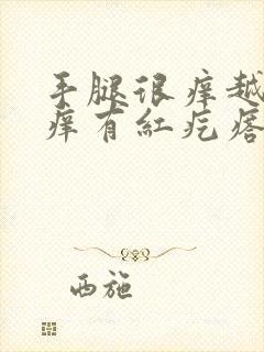 手腿很痒越抓越痒有红疙瘩