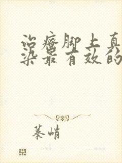 治疗脚上真菌感染最有效的药封面