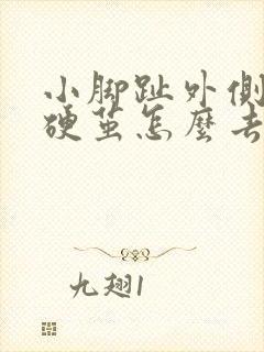 小脚趾外侧长了硬茧怎么去除封面