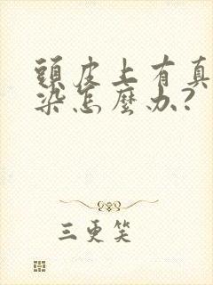 头皮上有真菌感染怎么办?