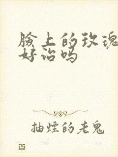 脸上的玫瑰痤疮好治吗