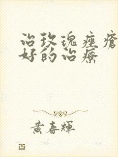 治玫瑰痤疮比较好的治疗