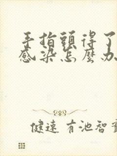 手指头得了真菌感染怎么办?