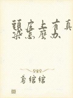 头皮上有真菌感染怎么办