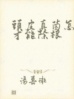 头皮真菌怎么治才能除根