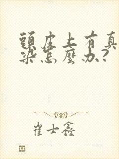 头皮上有真菌感染怎么办?