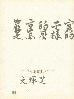 严重的子宫脱垂是怎么样的