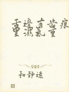 舌边有齿痕是哪里湿气重