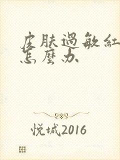 皮肤过敏红点痒怎么办