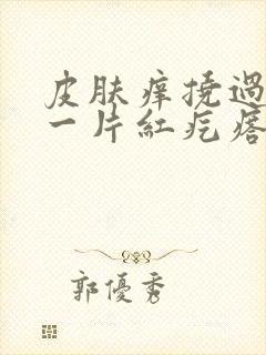 皮肤痒挠过后就一片红疙瘩