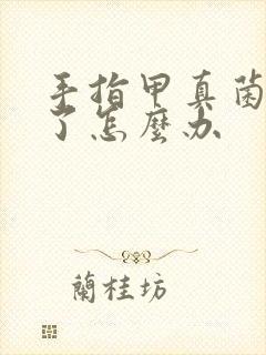 手指甲真菌感染了怎么办