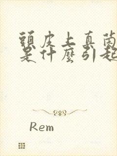 头皮上真菌感染是什么引起的