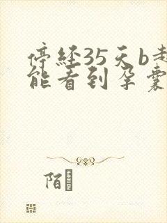 停经35天b超能看到孕囊吗