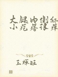 大腿内侧红色的小疙瘩很痒