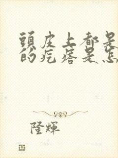 头皮上都是红色的疙瘩是怎么回事