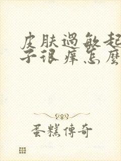 皮肤过敏起红疹子很痒怎么快速止痒