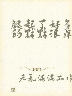 腿起了好多红色的点点很痒