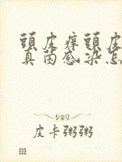 头皮痒头皮屑多真菌感染怎么办