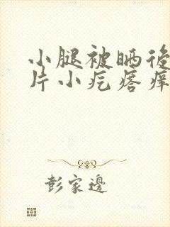 小腿被晒后起成片小疙瘩痒封面