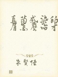 真菌感染的头皮屑怎么治才能除根