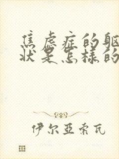 焦虑症的躯体症状是怎样的