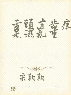 舌头有齿痕是不是湿气重