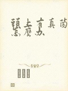 头上有真菌感染怎么办封面