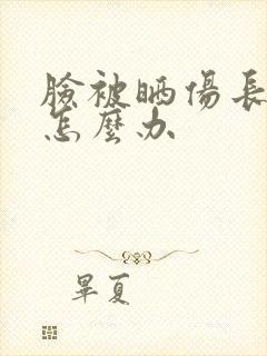 脸被晒伤长痘痒怎么办