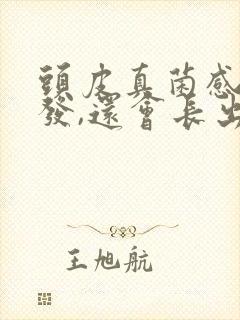 头皮真菌感染掉发,还会长出了吗?