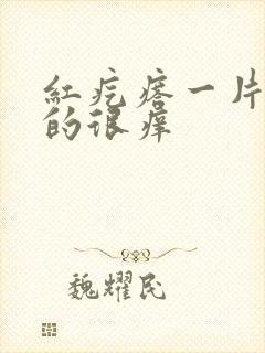 红疙瘩一片一片的很痒