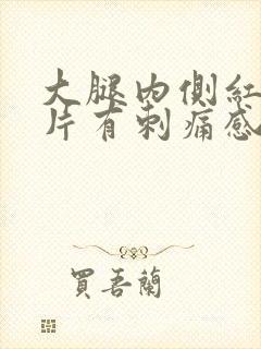 大腿内侧红了一片有刺痛感封面