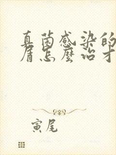 真菌感染的头皮屑怎么治才能除根