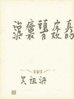 治疗头皮真菌感染最有效的药