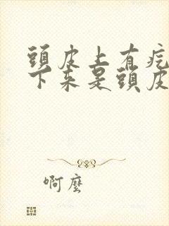 头皮上有疙瘩抠下来是头皮