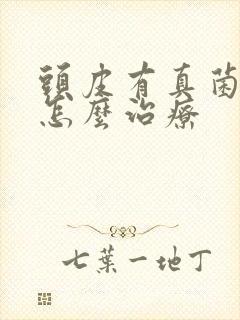 头皮有真菌感染怎么治疗封面