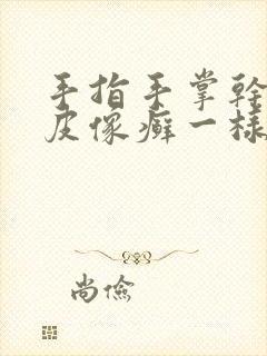 手指手掌干裂硬皮像癣一样