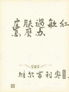 皮肤过敏红脱皮怎么办