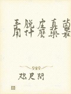 手脱皮真菌感染用什么药最好