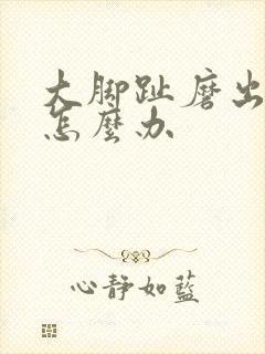 大脚趾磨出茧子怎么办