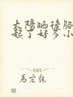 太阳晒后胳膊上起了好多小疙瘩很痒